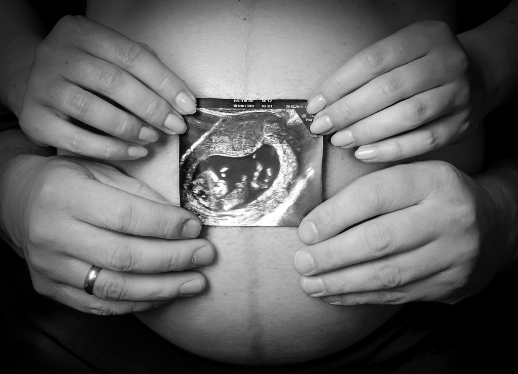 sesja ciążowa fotograf poznań, sesja ciążowa w poznaniu, fotografia ciążowa, najlepsza fotograf ciążowy (3)